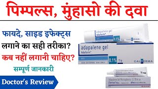 Adapalene Gel Uses Side Effects Review in Hindi  How to Apply Adapalene Gel  Pimples Ki Cream [upl. by Artimed525]