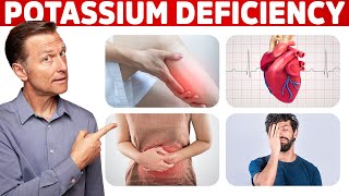 Low Potassium Signs Symptoms Causes and Treatment [upl. by Ybroc305]