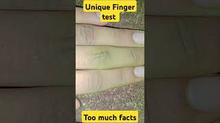 Try this new finger test shortvideos ytshortsvideo [upl. by Alag]