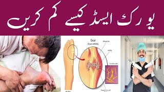 How to reduce Uric Acid I Causes I sign amp Symptoms I treatment I Bilqees Memorial Hospital [upl. by Umont373]