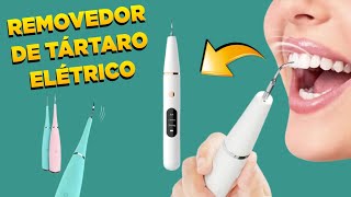 Removedor de Tártaro Elétrico [upl. by Kurt]