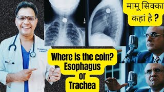 coin in chest Xray Trachea or Esophagus radiology ENTneet [upl. by Duffy]