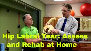 Hip Labrum Tear How to Assess amp Rehab at Home [upl. by Macilroy]