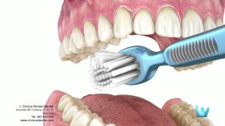 Higiene dental  Clinica identis [upl. by Havard]