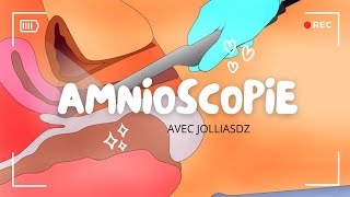 Amnioscopie [upl. by Morville]