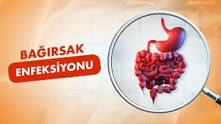 🦠 Bağırsak Enfeksiyonu Nedir│Sebepleri Tedavisi Beslenme [upl. by Irem6]