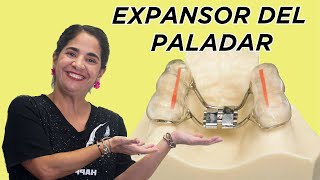 Expansor del paladar [upl. by Zohar]