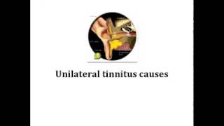 causes of tinnitus [upl. by Nitnerb]