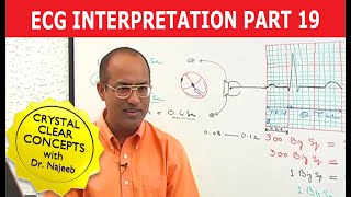 EKG or ECG Interpretation  Part 1920 [upl. by Nawj]