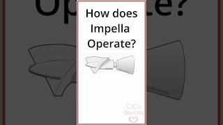 HOW DOES IMPELLA OPERATE PHYSICS impella [upl. by Sherburn861]