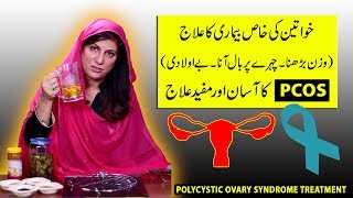 Best Natural Treatment for PCOS  PCOD Polycystic ovary syndrome by Dr Bilquis Shaiikh [upl. by Welford98]