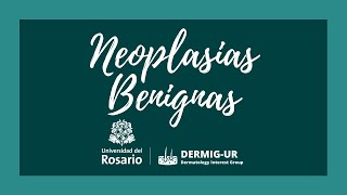 Neoplasias benignas  club de fotos [upl. by Ytok]