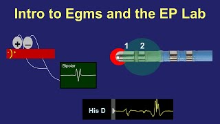 Intro to Intracardiac Electrograms amp the EP Lab [upl. by Belshin]