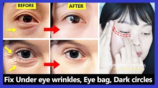 Only 6 mins Eye rejuvenation Get rid of under eye wrinkles dark circles eye bags Crows feet [upl. by Anawaj19]