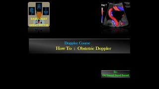 How to Obstetric  Fetal Doppler Handson DrIsmail Sayed Ismail [upl. by Chlori275]