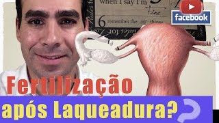 🔴AOVIVO Fertilização invitro após LAQUEADURA [upl. by Viehmann31]