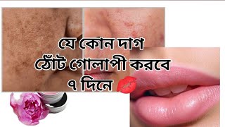 যেকোন কালো দাগ ও ঠোঁট গোলাপী করবে👄🫢 মাত্র ৭ দিনেLip pink korar upai skincare beauty রূপচর্চা [upl. by Nally]