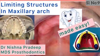 Limiting Structures in Maxillary arch Anatomical LandmarksPart 2 Sl No9 [upl. by Maccarone710]