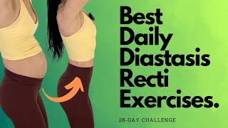 Heal amp Flatten With These Daily Diastasis Recti Exercises [upl. by Ettennahs]