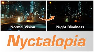 Night Blindness Nyctalopia  Causes amp Treatments [upl. by Siulesoj]