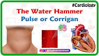 The water hammer pulse or Corrigan hyperkinetic pulse  usmle cardiology [upl. by Airrej]