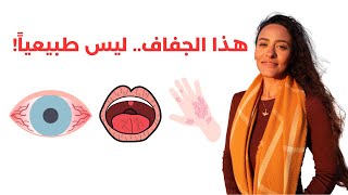 أهم الأطعمة لعلاج جفاف العين والفم والجلد  علاج متلازمة شوجرن [upl. by Steinman]