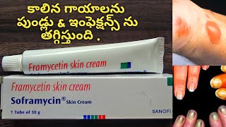 Allergies and skin Burns with soframycin cream in allopathic in Telugu l wounds l scabies l nails [upl. by Femi557]