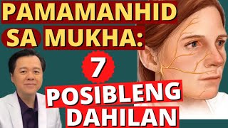 Pamamanhid ng Mukha 7 Posibleng Dahilan  By Doc Willie Ong Internist and Cardiologist [upl. by Yennaiv]