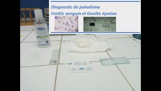 Diagnostic de paludisme  Frottis sanguin et Goutte épaisse [upl. by Tletski64]