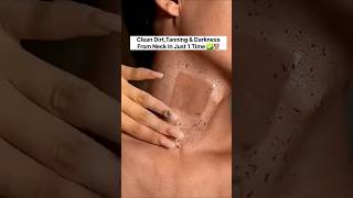 ✅Neck Cleaning Tips Dark Neck Home Remedies  Tanning Removal Tips😱 [upl. by Margo906]