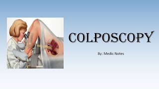 OampG Colposcopy  for medical students indications procedure abnormal results [upl. by Lekim182]