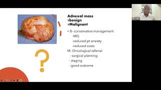 Ultrasound assessment of adnexal masses in malignancy prediction [upl. by Medora]