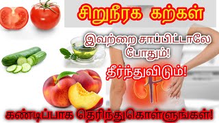 Kidney stone symptoms in TamilKidney stone Treatment in Tamil [upl. by Alyahsat]