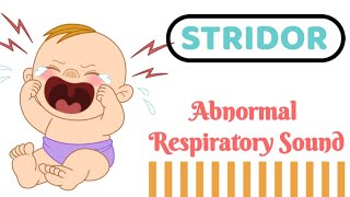 STRIDOR  Audible Respiratory sound [upl. by Koetke]