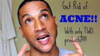 The Acne Solution How I cleared up my ACNE [upl. by Seessel890]