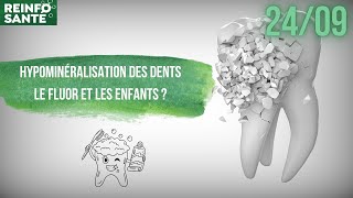 Hypominéralisation des dents le Fluor et les enfants [upl. by Teryn]