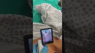 Procedure CFM  McGrath Intubation Videolaryngoscopy [upl. by Eiryk674]