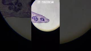 Ts of liver fluke under microscope 🔬youtube microscopeview [upl. by Vevina]