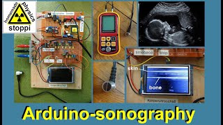 body ultrasound sonography with arduino  Sonographie mit Arduino [upl. by Haidabez660]