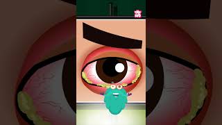 What Is Pink Eye What Causes Conjunctivitis shorts pinkeye conjunctivitis drbinocsshow [upl. by Ekud]