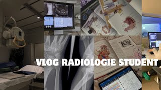 Technicien spécialisé en radiologie يوميات تقني أشعة [upl. by Anomor]