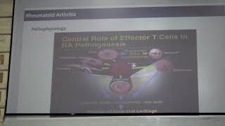 Rheumatology  CBL  Polyarthritis  DrWaleed [upl. by Bobine]