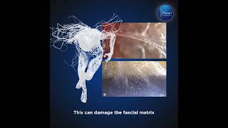 Uterus Fascial Adhesion Therapy fascia fasciarelease visceralmanipulation uterushealth uterus [upl. by Allan]