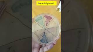 Bacterial growth  Bacteria identification  UTI Media  shorts microbilogy [upl. by Cerallua480]