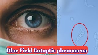 what is Blue field entoptic phenomena 🤔 best Animation video [upl. by Devine964]