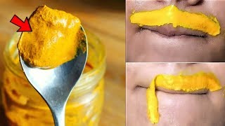 How to Remove Upper Lip Hair At Home Immediately Permanently In 5 Minutes – Remove Hairs Overnight [upl. by Reffinnej]