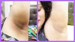 How to LIGHTEN DARK UNDERARMS WITHIN 10 MINS  Baking Soda amp Licorice Powder  Lighten Skin  ARATA [upl. by Falconer]