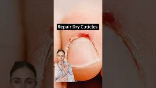 Revive Your Nails Fixing Damaged Cuticles [upl. by Romie]