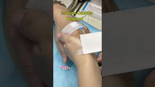 Infusion Cannula On Hand medical reels cannula shorts youtubeshorts [upl. by Kurman47]