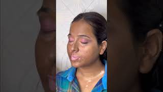 Vitiligo skin makeup mini tutorial quickandeasymakeuplook makeup [upl. by Charleton]